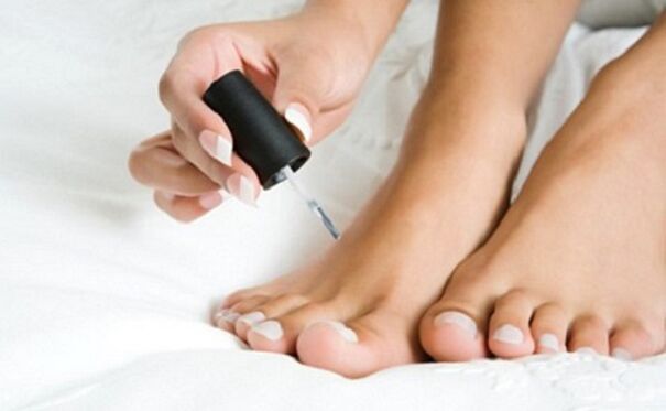Varnis healing from nail fungus