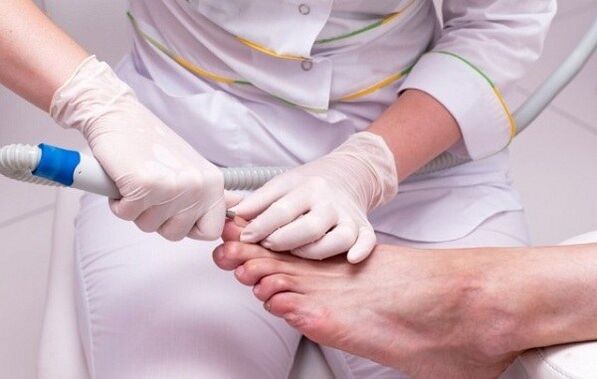 Treatment procedures for toenail fungus